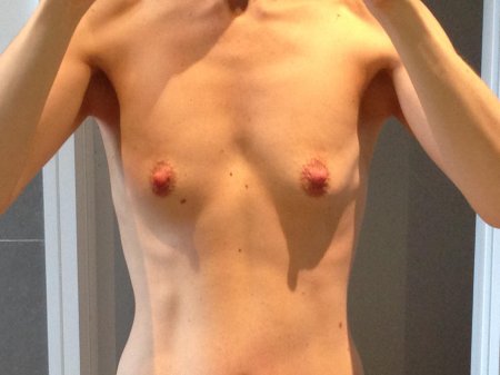 Плоские сиськи