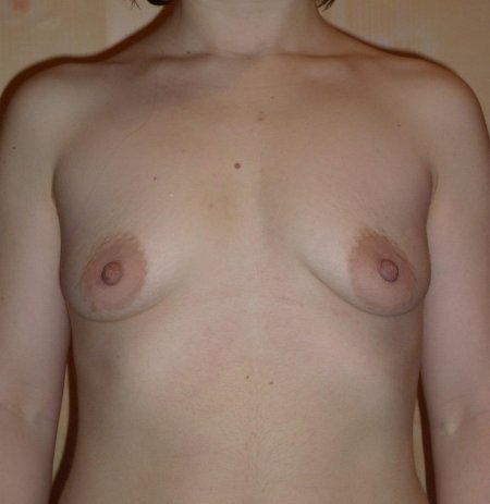 Маленькая женская грудь