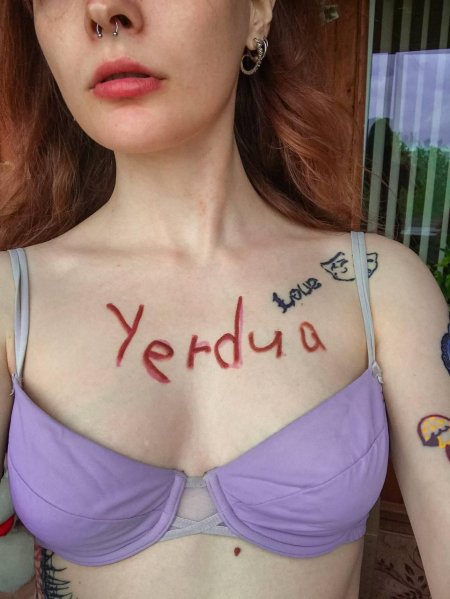 Сигмы на теле девушек