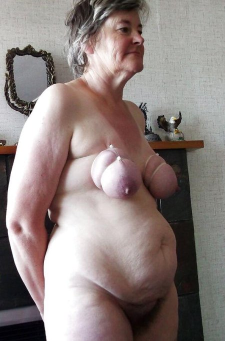 Женщина с одной грудью