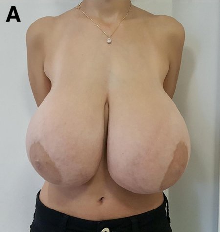 Огромные груди