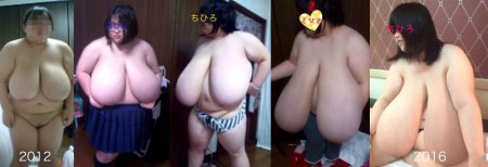 Макромастия гигантомастия гренни