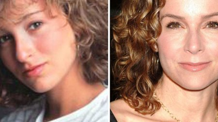 Дженнифер грей до и после операции