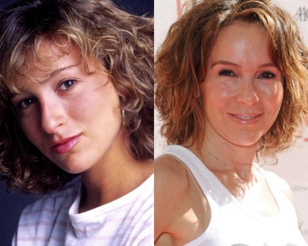 Дженнифер грей после операции