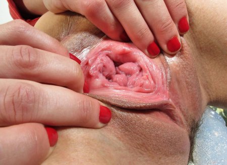 Вагина вывернутая наизнанку