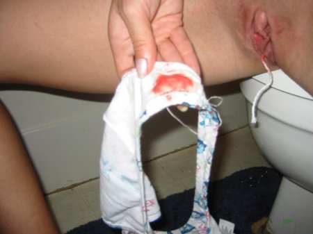 Прокладки женские с кровью