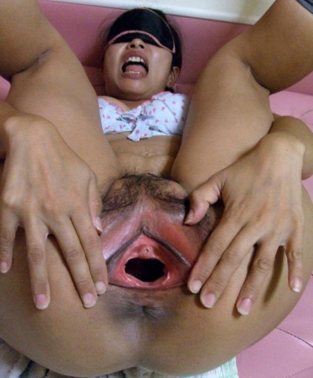 Огромное растянутое влагалище