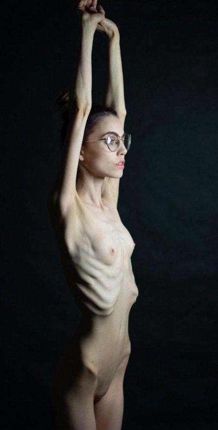 Очень худая девушка