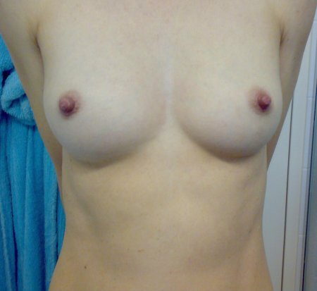 Голая грудь первого размера