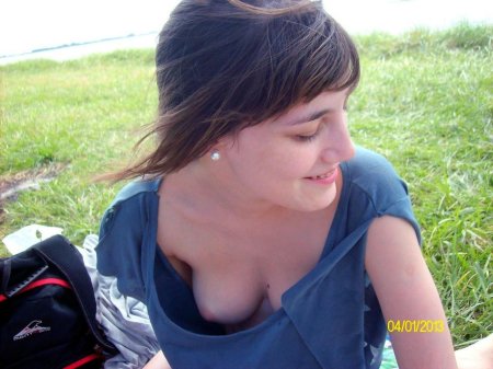 Засвет соска