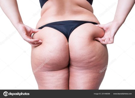 Большие целлюлитные ягодицы
