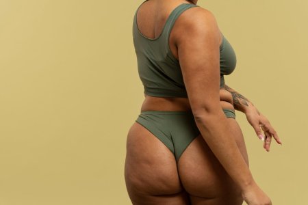 Голые целлюлитные женщины