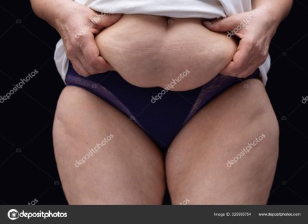 Женщина с толстым животом