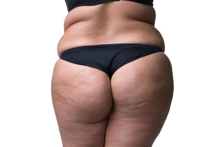 Полные ягодицы