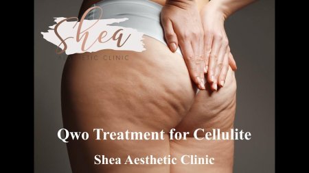 Cellulite treatment