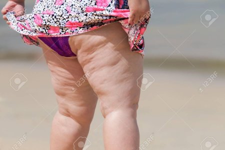 Толстые женщины на пляже