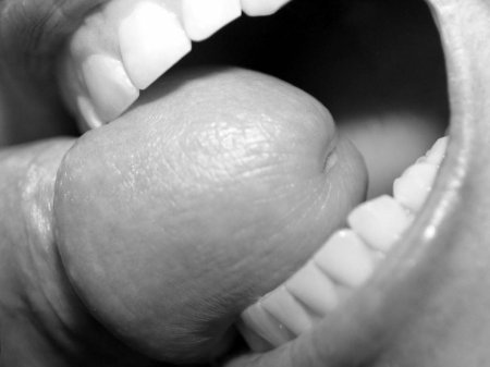 Улыбка зубами