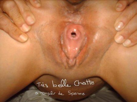 Вагинальный фистинг