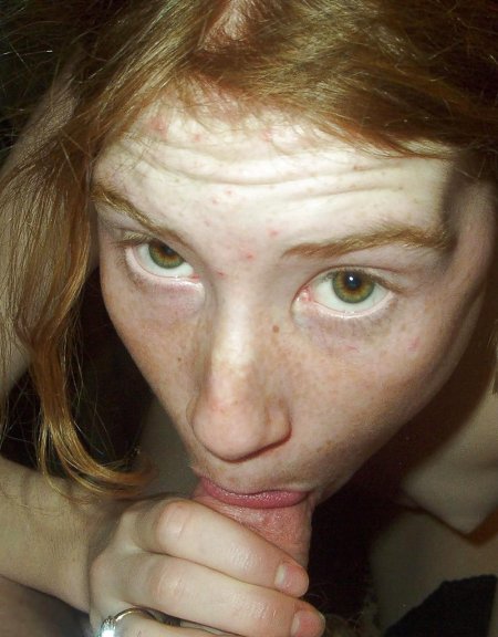 Red hair freckles
