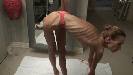 Девушки с анорексией