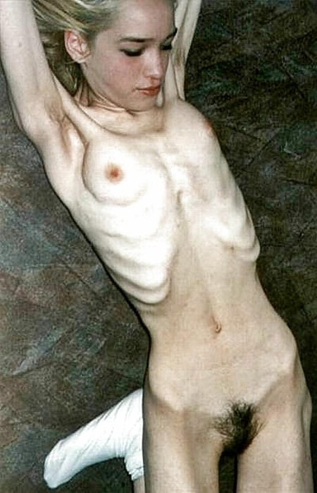 Лануго анорексия