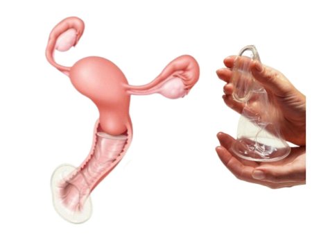 Вагинальные презервативы