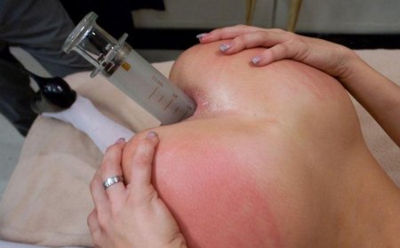 Укол в анал