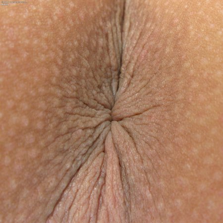 Анус женщин