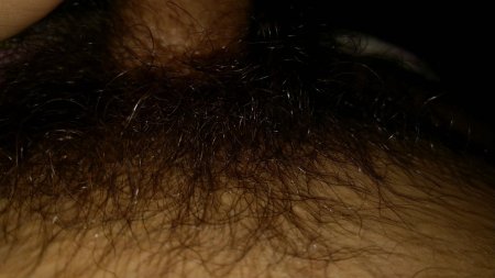 Самые длинные лобковые волосы