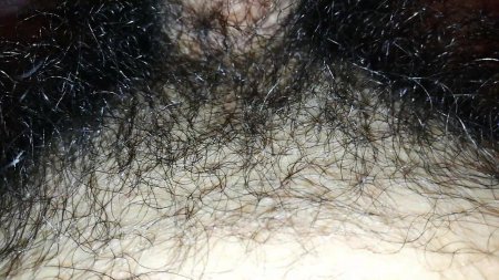 Волос на лобке