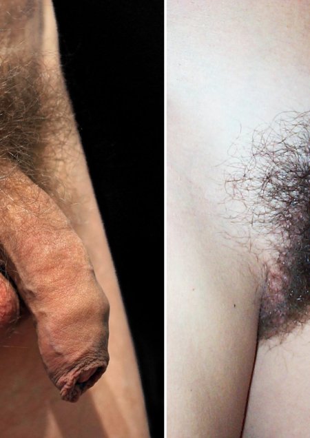 Лобковые волосы у мужчин