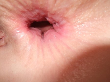 Женский анус крупным планом