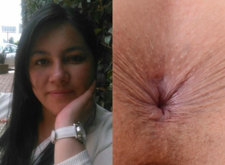 Женские анус