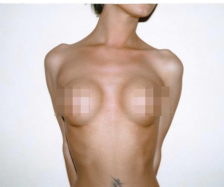 Силиконовые сиськи размер