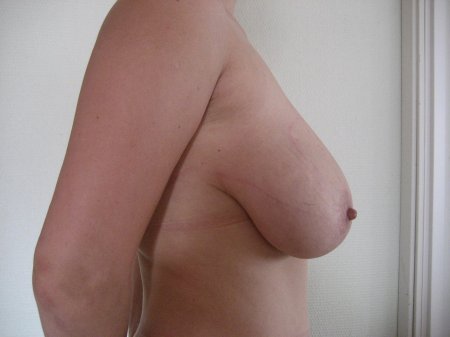 Отвисшая женская грудь