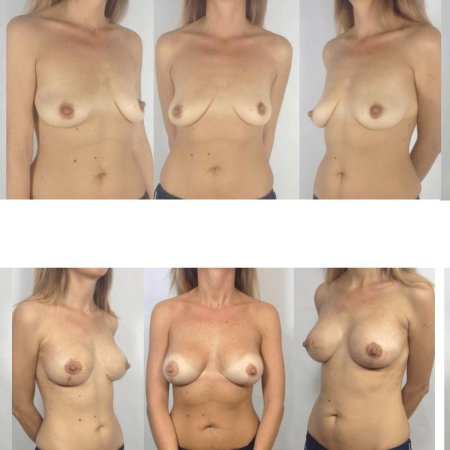 Формы голой женской груди