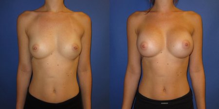 Голые женские груди