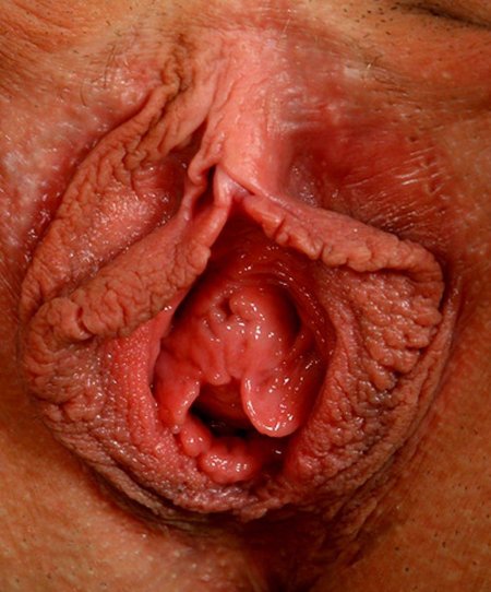 Влагалище здоровой женщины