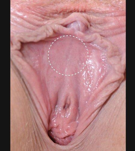 Женская вагина