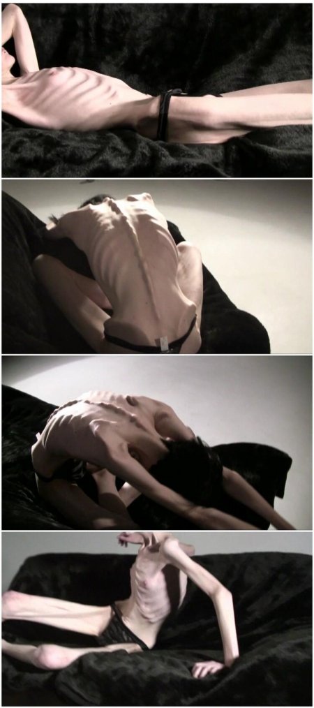 Анорексия восстановление ххх