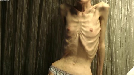 Больные анорексией