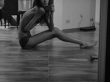 Елистратова софия анорексия