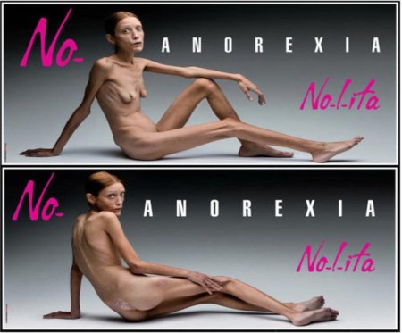 Изабель каро анорексия ню