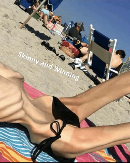 Анорексия тело