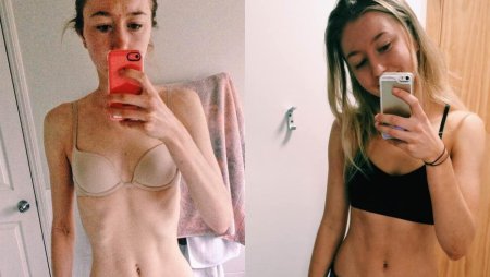 Тело анорексия