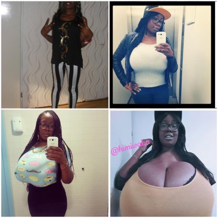 Макромастия гигантомастия