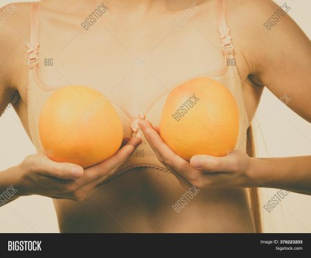 Сиси апельсин